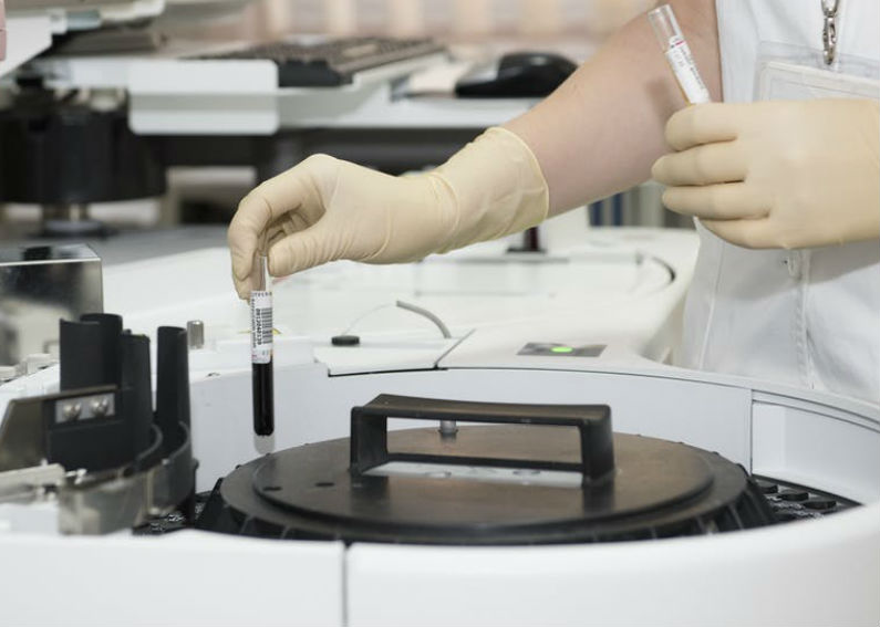 Lab Logistics Aids in the Fight Against COVID19 Lab Logistics